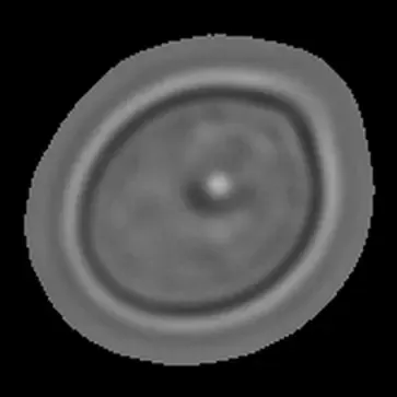 Microscopy image of a single fungal cell captured by the reader, showing the cell wall and internal structure used by the AI model for identification