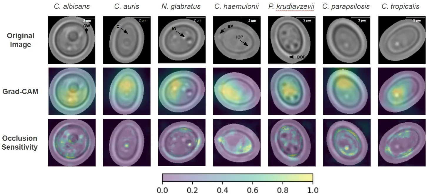 Attribution grid across all seven target species (C. albicans, C. auris, N. glabratus, C. haemulonii, P. kudriavzevii, C. parapsilosis, C. tropicalis), showing the original microscopy image, the Grad-CAM activation map, and the occlusion-sensitivity map for each species